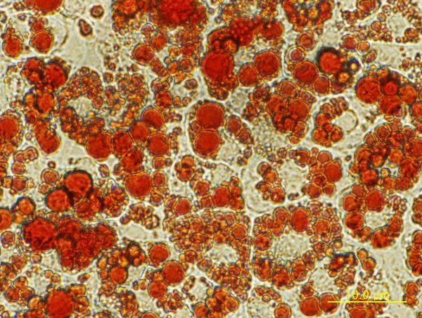 Microscópicas - adipócitos