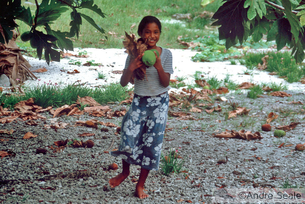 Criança Marshalhesa - bomba atômica nas Ilhas Marshall