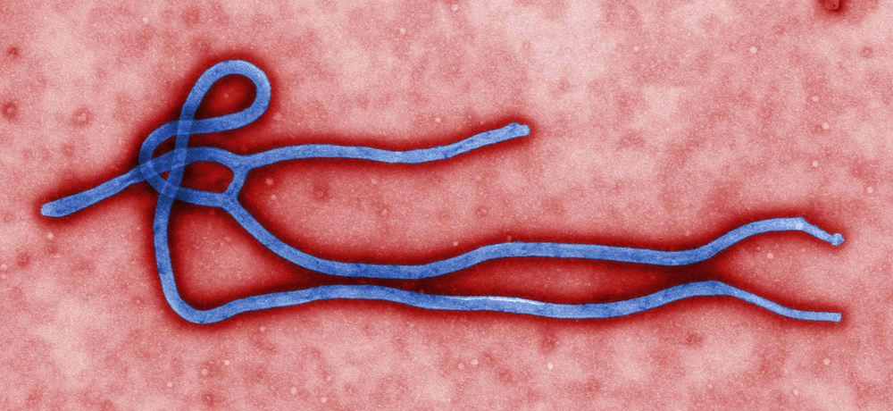 Estrutura do Vírus do Ebola - epidemia de 2014